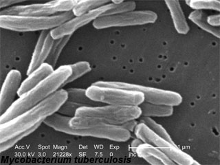 File:Mycobacterium-tuberculosis.jpg