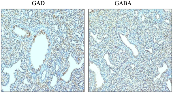Immunolocalisation of GAD and GABA receptors in fetal lung tissue sections in mice.png