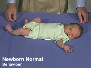 Link=Neural_Exam_Movies#Newborn