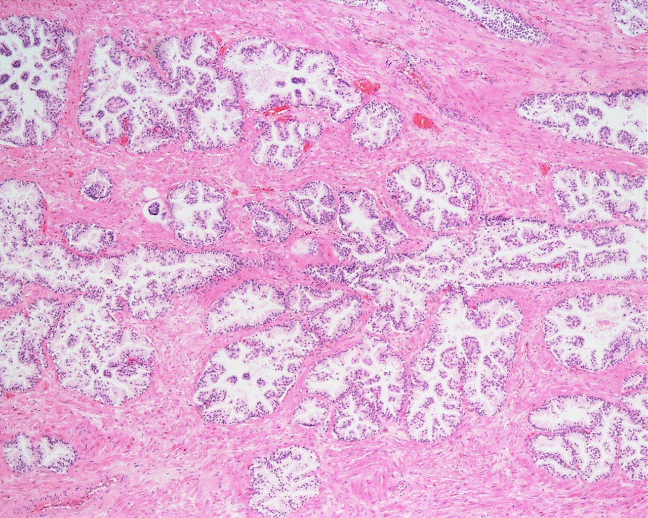 File:Prostate histology 04.jpg - Embryology