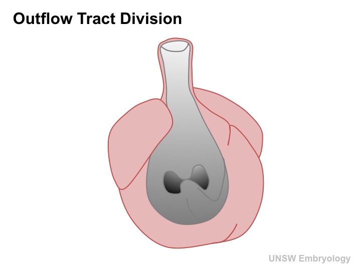 Outflow tract 001 icon.jpg