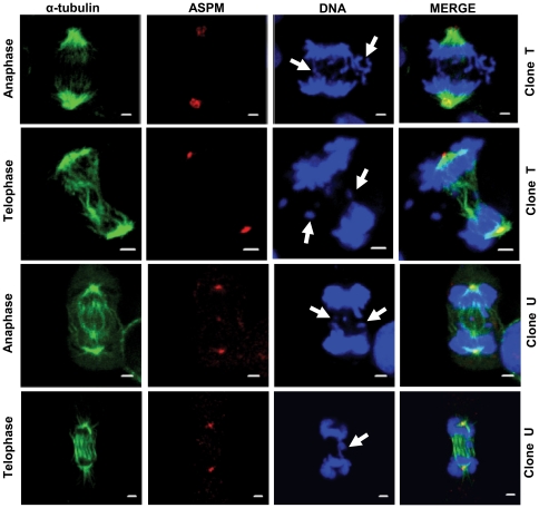 File:Chromosome segregation defects associated with abnormal spindles in UBE3A shRNA knockdown clones.jpg