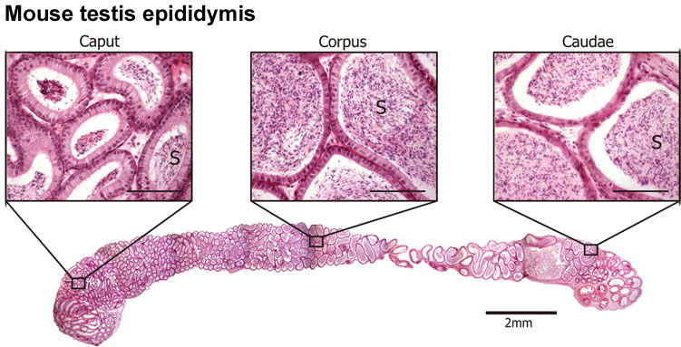 File:Mouse- epididymis histology.jpg