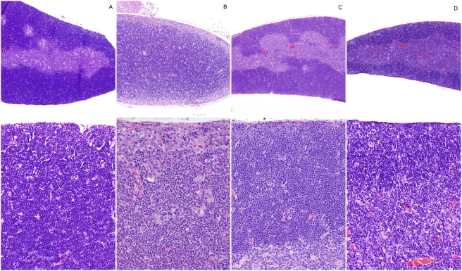 File:Histopathology of the thymus with hyperplasia.jpg
