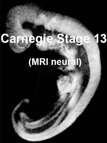 File:Stage13 MRI 3D02 icon.jpg