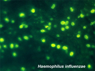 Haemophilus-influenzae.jpg