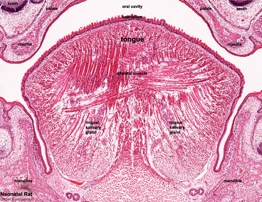 File:Developing tongue histology 001.jpg - Embryology
