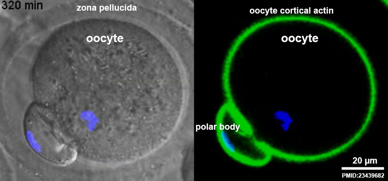 File:Oocyte meiosis movie 01 frame 4.jpg