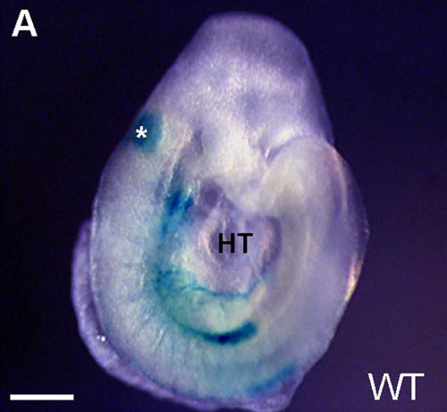 File:Otic placode embryo.jpg