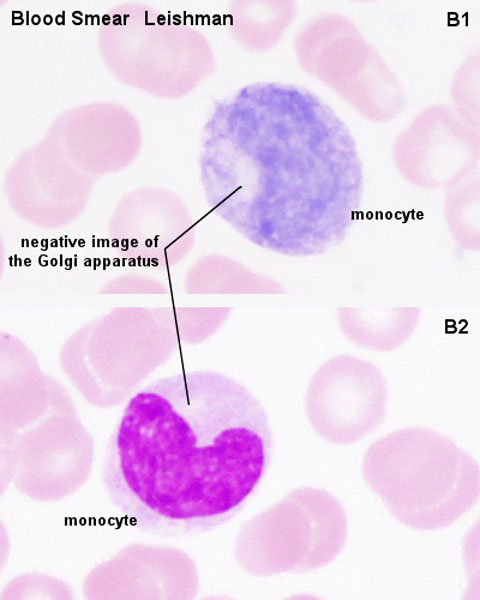 File:Monocyte 01.jpg