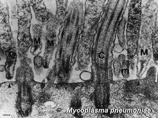 File:Mycoplasma-pneumoniae.jpg