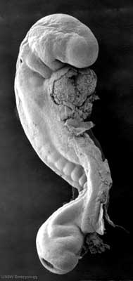 Human Embryo (stage 12, week 4) SEM