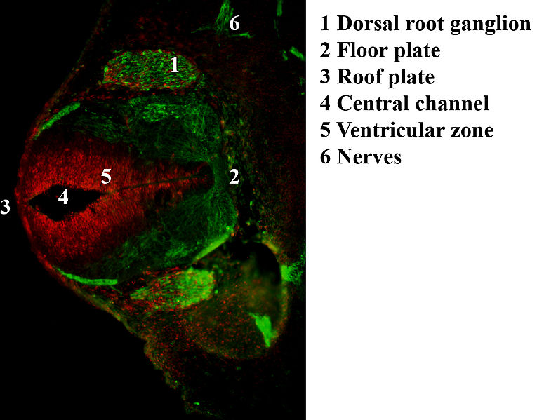 File:Embryonic dorsal root ganglia in mouse.jpg