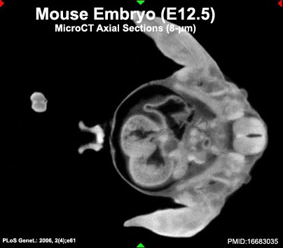 File:Mouse CT E12.5 axial movie.jpg