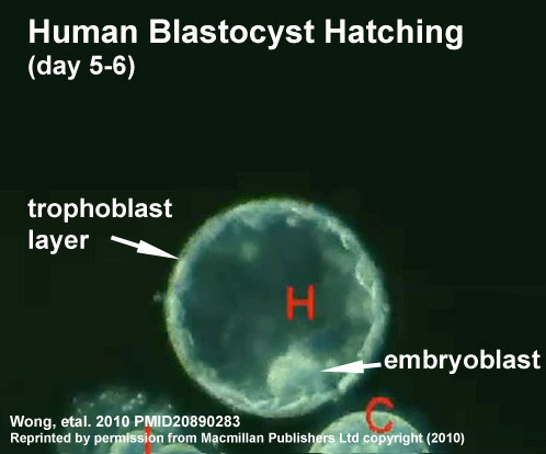 File:Human blastocyst hatching movie icon.jpg