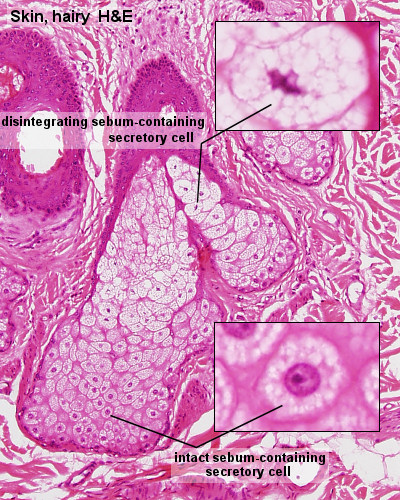 File:Integumentary- sebaceous gland histology 02.jpg
