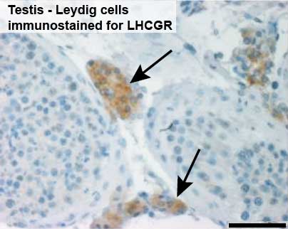 File:Leydig cells stained for LHCGR1.jpg