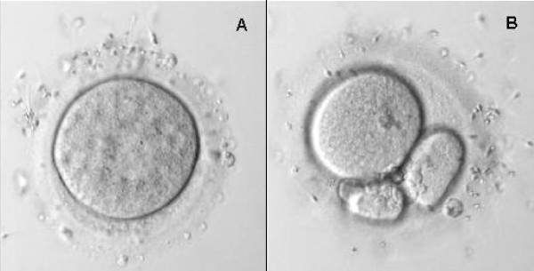 Sperm binding test using unfertilised and fertilised human oocytes