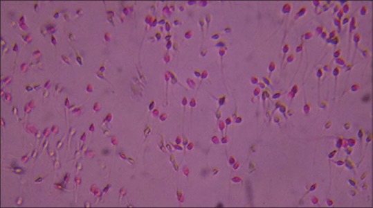 File:Non-viable spermatazoa.jpg