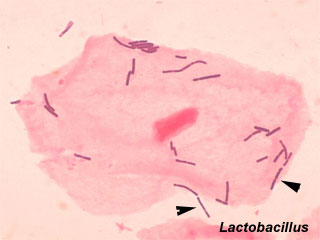 Lactobacillus.jpg