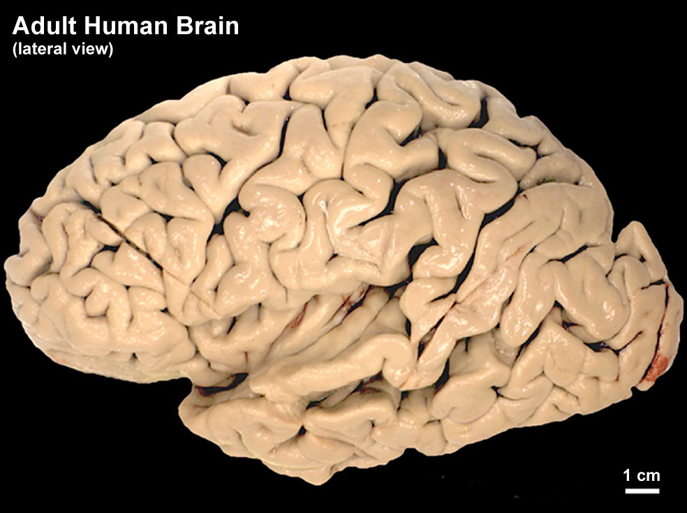 Adult human brain.jpg