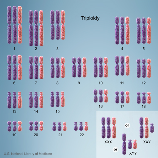 File:Chromosome- triploidy.jpg