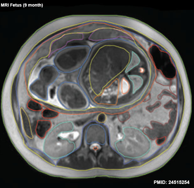 File:Fetal 9 month MRI 02.jpg