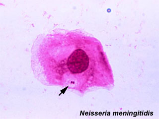 File:Neisseria-meningitidis2.jpg