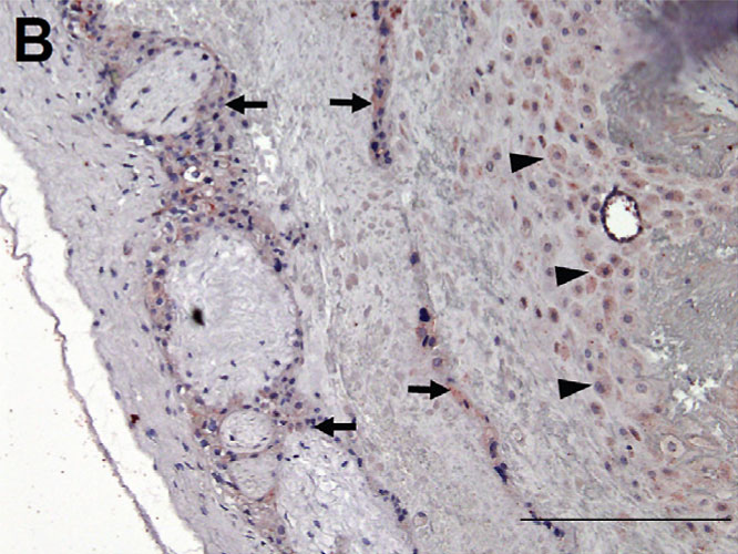 File:Placenta histology 006.jpg
