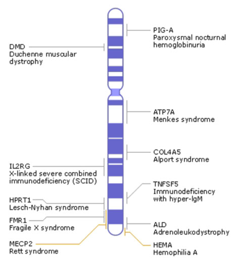 File:Human idiogram- X chromosome diseases.jpg