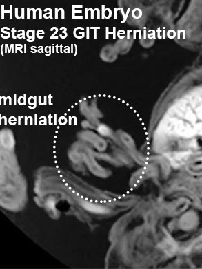 File:Stage23 MRI S04 icon.jpg