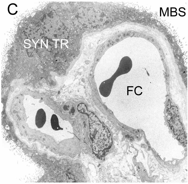Haemomonochorial human placenta villi (EM) showing syncitiotrophoblast cells.[7]