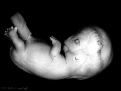BGDA Practical 12 - Embryo to Fetus - Embryology