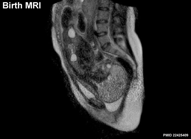 File:Birth MRI icon.jpg