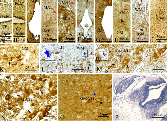 File:Figure 1 – Immunohistochemical staining of β-catenin in spinal cord at different gestational ages.png