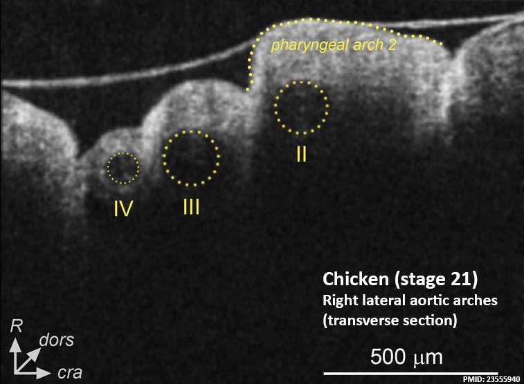 File:Chicken HH21 aortic arch icon.jpg