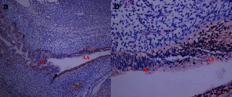 P63 staining of human anorectum in 10th week.jpg