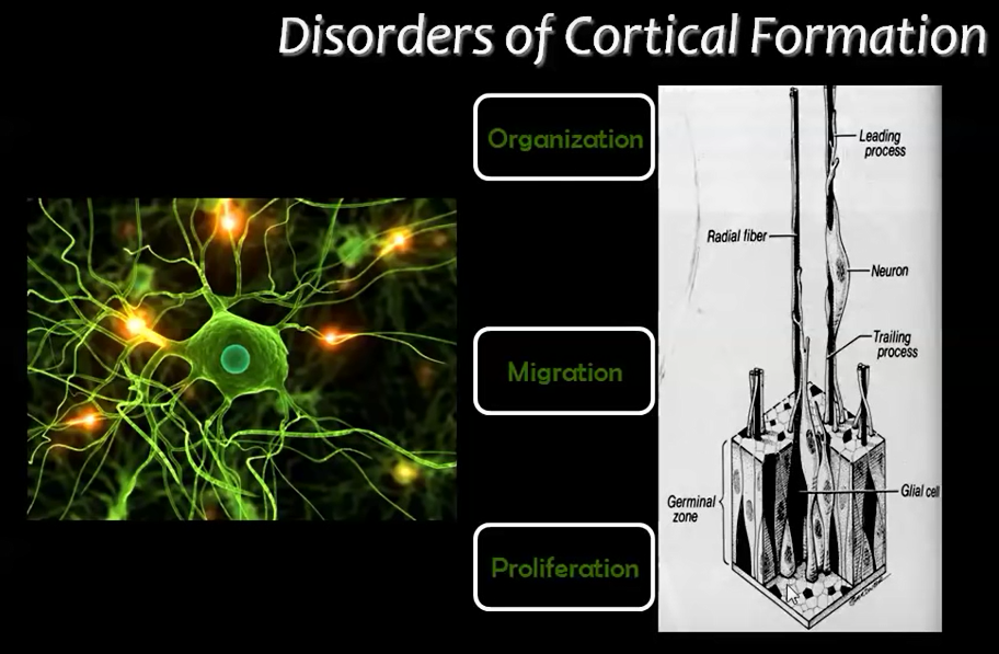 Main stages of cortical development where abnormalities may arise