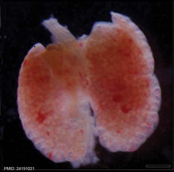 File:Mouse whole lung E14.5.jpg