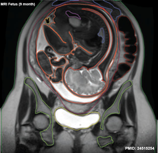 File:Fetal 9 month MRI 03.jpg