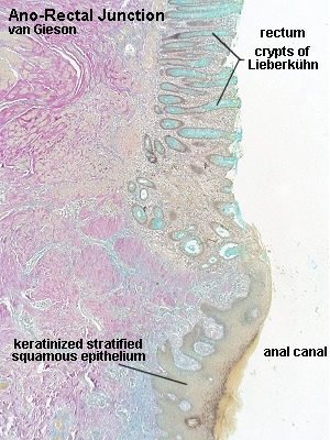 Large Intestine Microscope Labeled