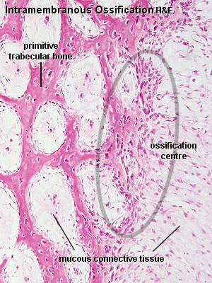 File:Ossification centre.jpg - Embryology