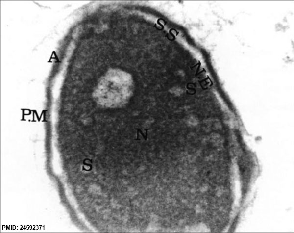 File:Human spermatozoa nucleus EM03.jpg