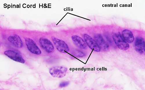 File:Spinal cord histology 10.jpg