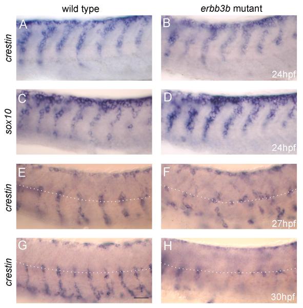 Comparison of neural crest cell migration between erbb3b mutants and wildtype zebrafish models.