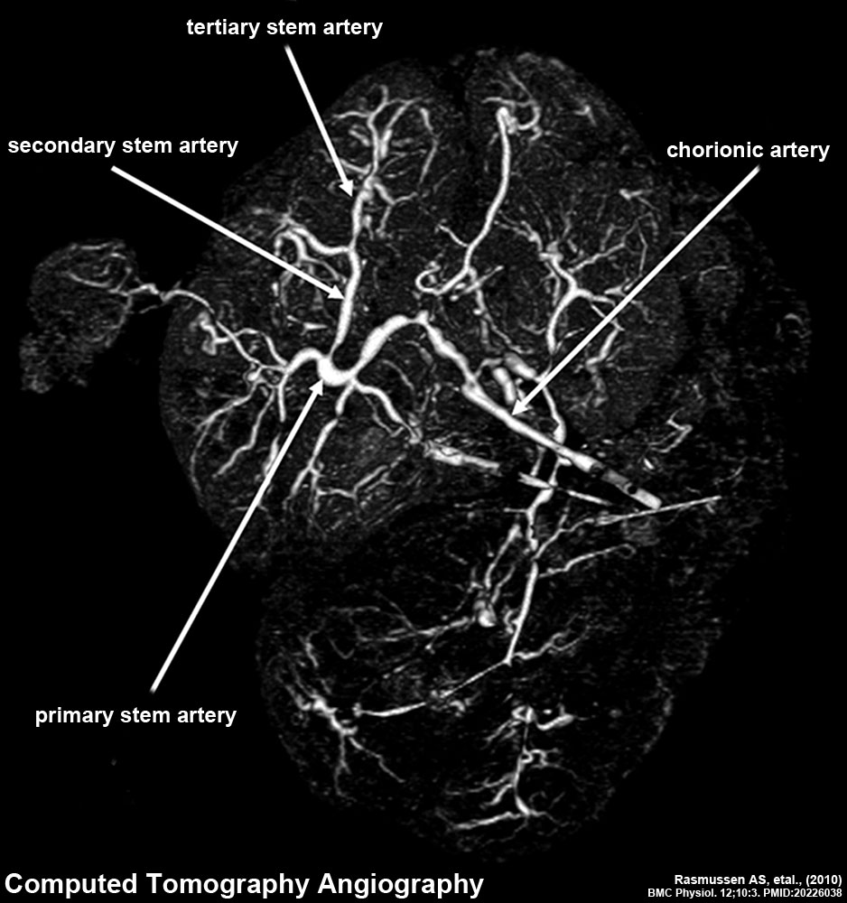 Image - computed tomography
