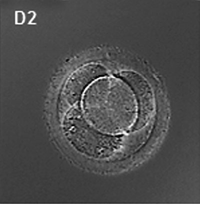 File:Human embryo day 2.jpg