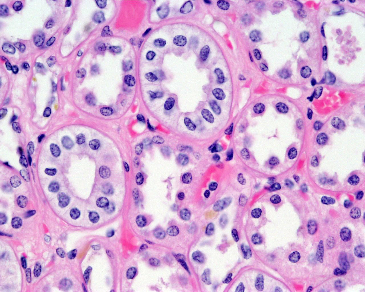 Kidney Proximal Tubule Histology ZRYT