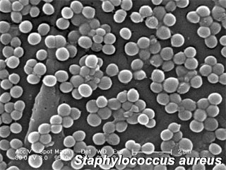 File:Staphylococcus-aureus.jpg
