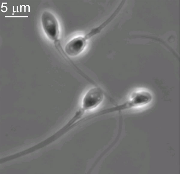 Human-spermatozoa.jpg